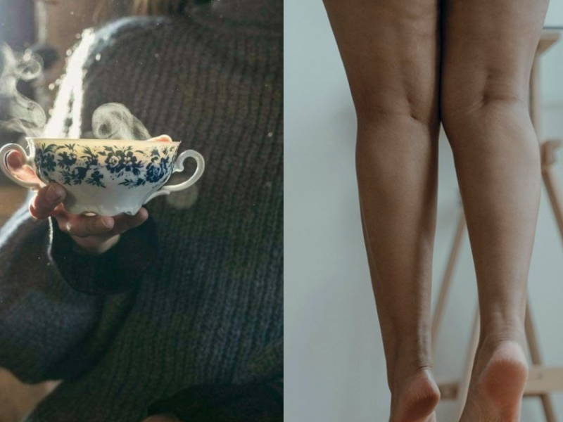  10 of Nature’s Most Effective Solutions for Edema
