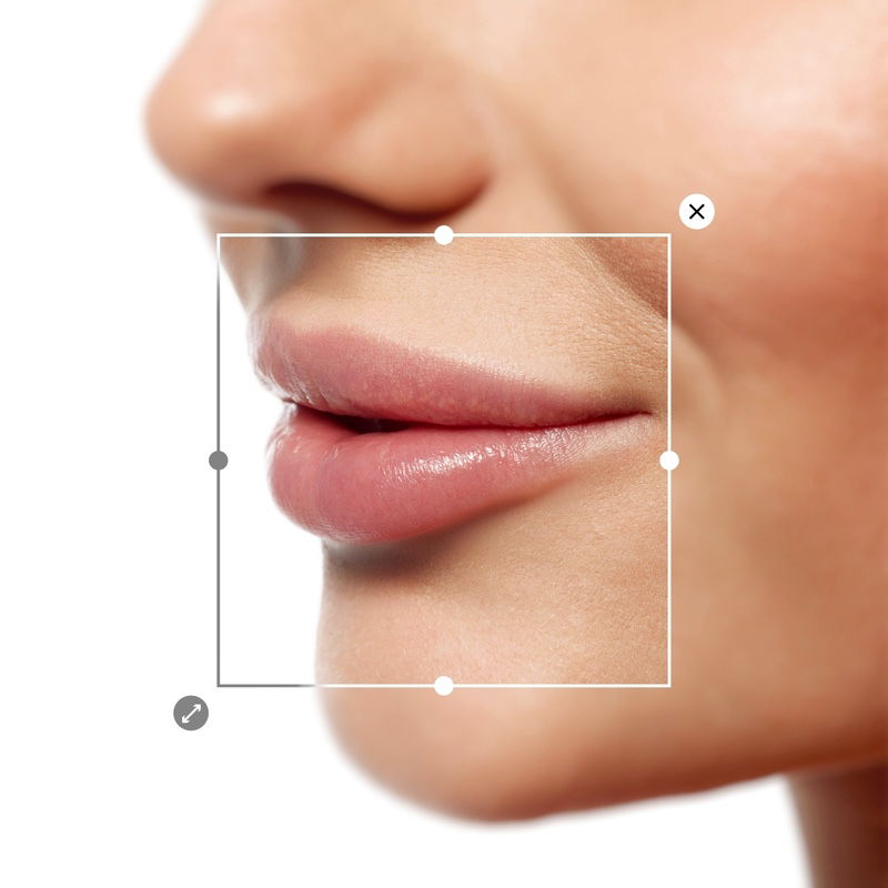 Lip Fillers 101: What to Know Before You Enhance Your Look