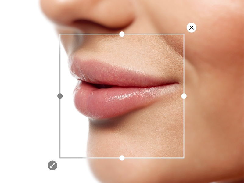 Lip Fillers 101: What to Know Before You Enhance Your Look